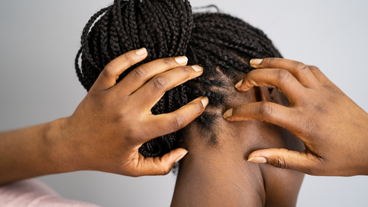 Say Goodbye to Dandruff: Understanding Mother Nature's Anti-Dandruff Remedies